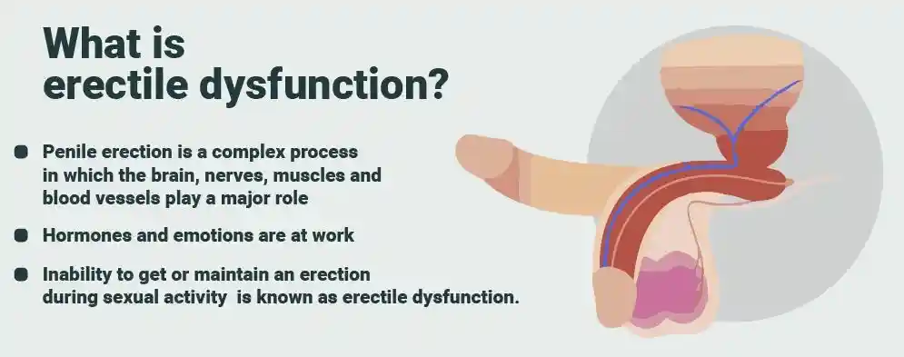 Cenforce 150 erectile dysfunction Cenforce 150 erectile dysfunction
